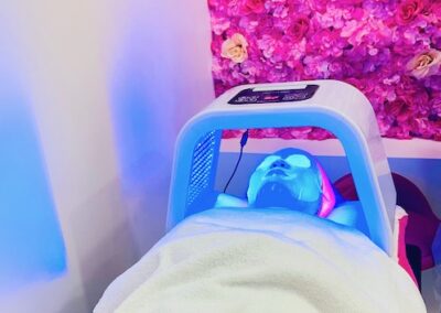 Microneedling course with LED therapy